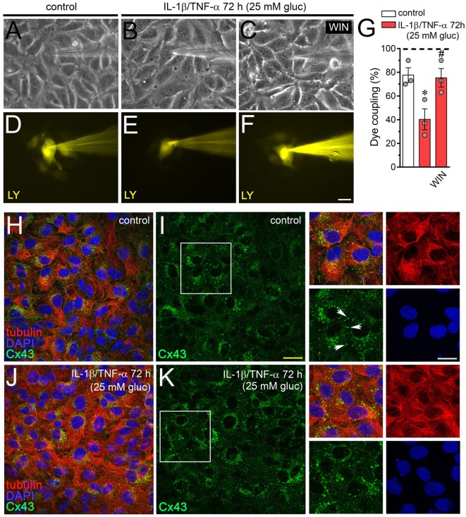 WIN prevents the high glucose and IL-1β/TNF-α-induced decrease in endothelial coupling through a mechanism that does not involve changes in connexin 43 (Cx43) distribution. (A–F) Representative fluorescence and phase contrast micrographs of Lucifer yellow (LY) transfer by EAhy cells treated for 72 h with 5 mM glucose [control (A,D)], 25 mM glucose, and IL-1β/TNF-α (B,E) alone or in combination with 5 µM WIN (C,F). (G) Averaged data of dye coupling (percentage of injections that resulted in LY transfer) of EAhy cells treated for 72 h with 5 mM glucose (control, white bar), 25 mM glucose, and IL-1β/TNF-α (red bars) alone or in combination with 5 µM WIN. *p < 0.05, IL-1β/TNF-α and high glucose compared to control; #p < 0.05, effect of each cannabinoid compared to the effect induced by IL-1β/TNF-α and high glucose (one-way analysis of variance followed by Dunnett’s post hoc test). Data were obtained from at least three independent experiments (see scatter dot plot) with four repeats each one (≥10 cells analyzed for each repeat). (H–K) Representative fluorescence images depicting Cx43 (green), tubulin (red), and DAPI (blue) immunolabeling of EAhy cells treated for 72 h with 5 mM glucose [control (H,I)] and 25 mM glucose plus IL-1β/TNF-α (J,K). Insets: 1.7× magnification of the indicated area of panels (I,K). White arrows indicate Cx43 labeling in cell–cell interfaces. Calibration bars: white = 35 µm, yellow = 60 µm, and green = 25 µm.