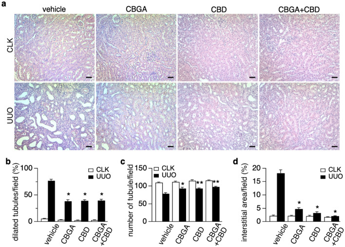 CBGA and CBD protect renal morphology in the UUO kidneys. (a) Representative images of HE stainings taken from CLK (upper panels) and UUO (lower panels) kidney sections (magnification × 200) from mice treated with vehicle, CBGA, CBD, CBGA + CBD. Scale bars represent 50 µm. (b, c) The number of dilated tubules (b) and total tubules (c) were counted and evaluated statistically in the CLK (white bars) and UUO kidneys (black bars) at day 7 after UUO. (d) The percentage of the interstitial area in the CLK (white bars) and UUO kidneys (black bars) were quantified using the sections stained for collagen type I (see Fig. 6a). *p < 0.05, **p < 0.01 vs. UUO kidneys treated with vehicle group.
