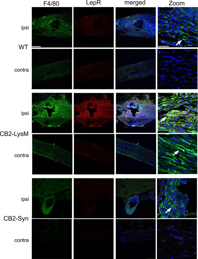 Coexpression of leptin receptor (red) with F4/80 (green). Sciatic nerve tissue of WT, CB2-LysM and CB2-Syn mice was stained 14 days post SNL. Leptin receptor signal was highest and co-labeled with the macrophage marker F4/80 in ipsilateral sciatic nerve of CB2-LysM mice compared to WT or CB2-Syn mice. Arrows show co-labeled cells. (scale = 250 µm, 63x zoom scale = 50 µm).