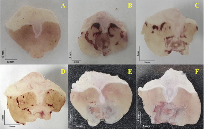 Six representative macroscopic images of excised mouse stomachs are shown, arranged in two rows of three panels labeled A to F. Each image displays an opened stomach specimen positioned flat for surface visualization. The gastric mucosa appears pale to light pink, with some specimens showing darker red or brownish areas distributed across the surface. The extent and distribution of these darker regions vary among panels. Tissue edges and overall stomach shape are visible in each image. All panels include a scale bar indicating a length of 5 millimeters, providing size reference for the gastric tissue samples.