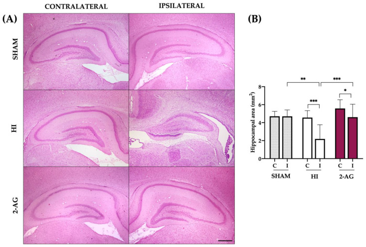 Hippocampal area reduction after HI is reverted with 2-AG treatment at P14. (A) Representative microphotographs of the contralateral and ipsilateral hippocampi from sham, HI, and 2-AG animals. Microphotographs were taken at 4× magnification (Scale bar: 500 μm). (B) The hippocampal area was significantly smaller on the ipsilateral side of the HI animals compared to the contralateral side (*** p < 0.001) and also to sham-I (** p < 0.01). The ipsilateral hippocampi of 2-AG treated animals were smaller (* p < 0.05) than the contralateral ones. This effect of HI was reverted after 2-AG treatment, as the hippocampal area in the ipsilateral hemisphere of 2-AG animals was significantly bigger (*** p < 0.001) than in HI animals and similar to sham-I.