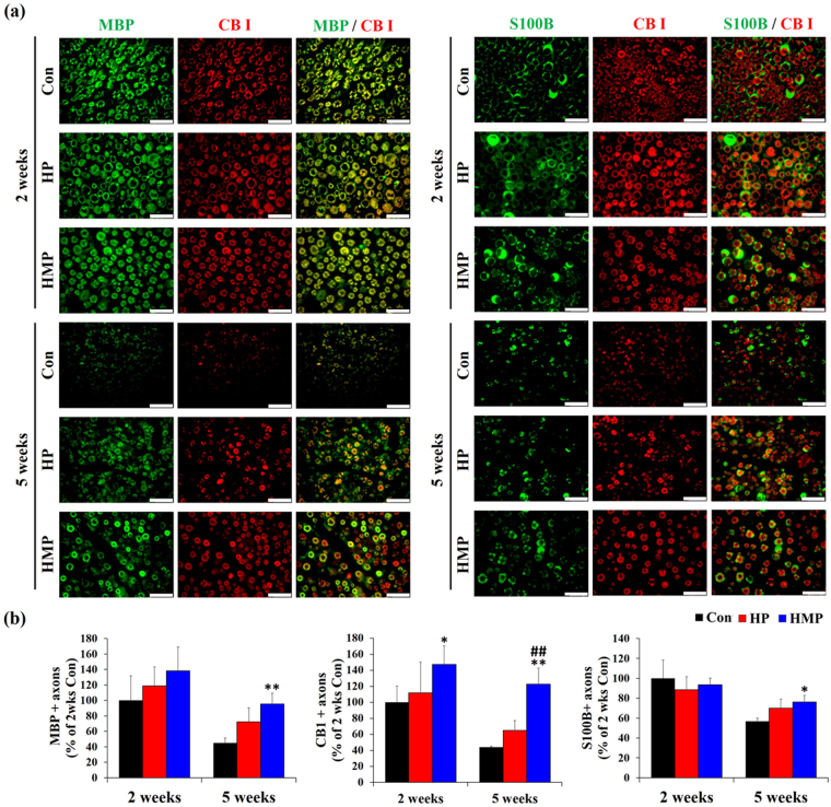 Double immunofluorescence staining for MBP, CB I, and S100B in the sciatic nerves at 2 and 5 weeks post-implantation. (a) Double immunofluorescence with antibodies to MBP, S100B (green) and CB I (red). Scale bar = 25 μm (b) Statistical analysis of double immunofluorescence staining (n = 3 per each group and each time point). Results are expressed as mean ± SD. *Compared to Con, #Compared to HP, *, # p < 0.05, **, ## p < 0.01; One-Way ANOVA analysis.