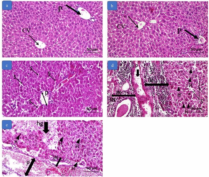 Photomicrographs of liver tissue by H&E. a and b section from the negative control and positive control group showing normal hepatocytes, central vein (CV), and portal vein (P). c section from group C (0.3 mg/kg) showing congested and dilated portal vein (P) and sinusoids (S). d section from group D (3 mg/kg) showing severely congested and dilated portal vein (P) and sinusoids (S), large foci of inflammatory cell infiltration (IN), and hepatocytes showing degeneration and apoptosis (H). e section from group E (10 mg/kg) showing severely congested and dilated portal vein (P), foci of inflammatory cell infiltration (IN), and hepatocytes showing degeneration and apoptosis (H). There is an area of interstitial hemorrhage (hg). (Magnification × 200)