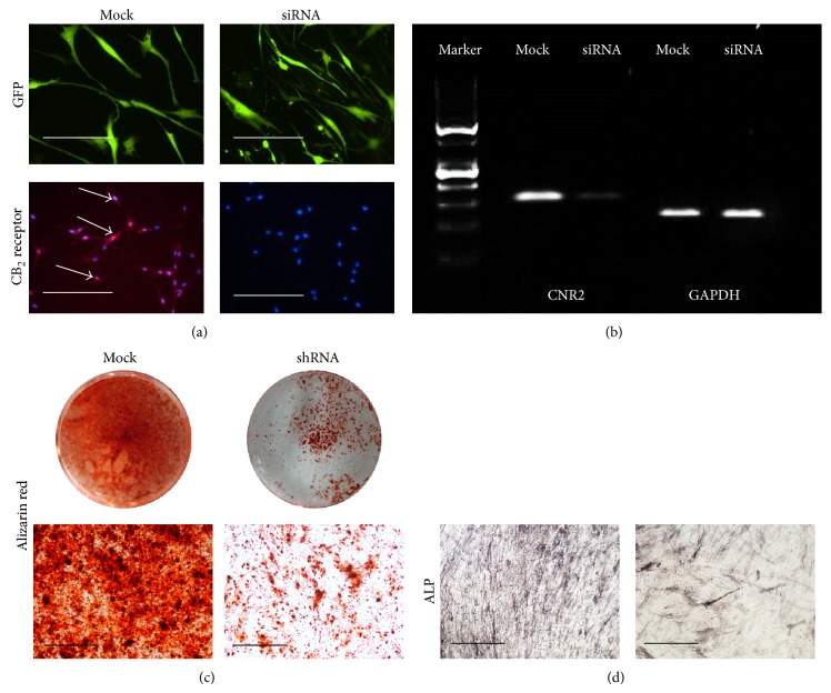 Osteogenic differentiation of BM-MSC was inhibited by knockdown of cannabinoid receptor 2. (a) BMSCs infected with virus containing shRNA sequence against cannabinoid receptor 2 (CNR2) or mock sequence. Green fluorescent protein (GFP) marks successfully infected cells. Bar = 100 μm. Immunofluorescent staining was performed to examine the expression of CB2 receptor on infected cells. White arrows indicate positive staining for CB2 receptor. (b) RT-PCR analysis of cannabinoid receptors (CNR) 1 and 2 genes in BM-MSC. Expression of cannabinoid receptor 2 was confirmed in BM-MSCs. GAPDH was used as internal control. PCR products were resolved on 2% agarose gel. (c) Alizarin red staining of BM-MSC after 3-week culture. Bar = 100 μm. (d) Alkaline phosphatase staining (ALP) after 2-week culture. Bar = 100 μm.