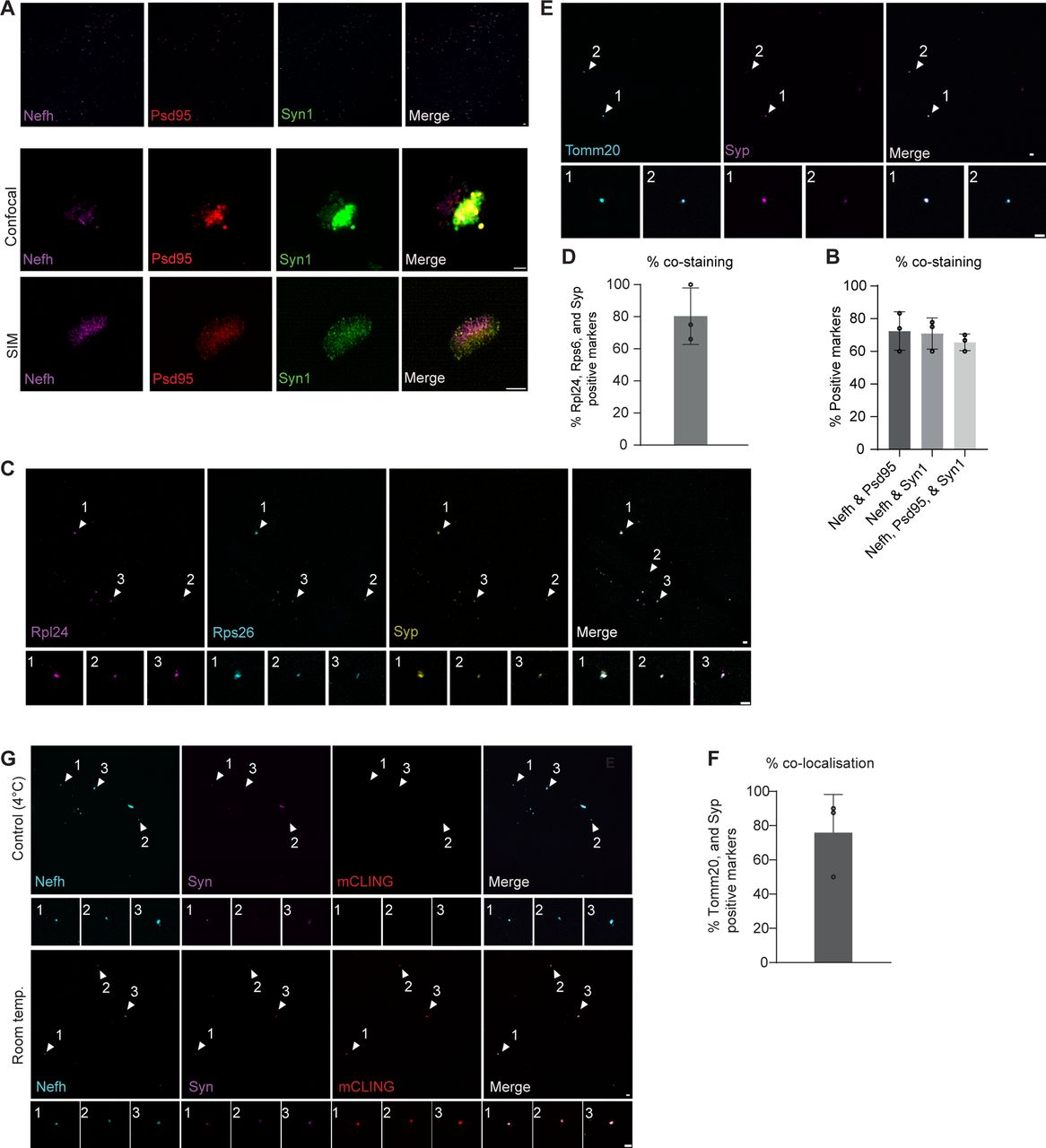 Isolated peripheral terminals contain mitochondrial and ribosomal components.(A) Representative images of immobilised peripheral nerves on coverslips and stained with Nefh, Psd95, and Syn1 (confocal 60x, confocal digital zoom, and SIM respectively). (B) Quantification of percent co-staining of Nefh and Psd95, Nefh and Syn1, and Nefh, Psd95, and Syn1 of (A). Data are meanL±Ls.d. of nL=L3 biological replicates. (C) Representative images of immobilised peripheral nerves on coverslips and stained with ribosomal markers RPL24 and S6 along with Synaptophysin. Data are meanL±Ls.d. of nL=L3 biological replicates. (D) Quantification of percent co-staining of ribosomal and synaptic markers of (C). Data are meanL±Ls.d. of nL=L3 biological replicates. (E) Representative images of immobilised peripheral nerves on coverslips and stained with mitochondrial marker, Tomm20 and Syp. Data are meanL±Ls.d. of nL=L3 biological replicates. (F) Quantification of percent co-staining of Tomm20 and Syp in (E). Data are meanL±Ls.d. of nL=L3 biological replicates. (G) Representative images showing the mCLING dye being endocytosed by the peripheral nerve endings at room temperature and absence of mCLING dye in the peripheral nerve endings at control (4°C). Scale bar: 5 µm.