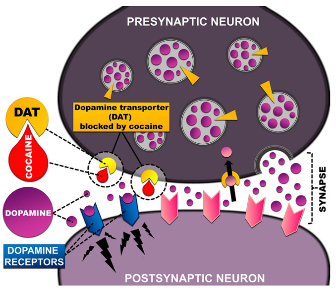 Mechanism of cocaine-induced DAT blockade in presynaptic neurons. Cocaine binds tightly to the dopamine transporter to form a complex and interfere with normal DAT activity. It thus inhibits the reuptake of neurotransmitters from the extracellular space. The transporter is unable to perform its function, leading to increased levels of neurotransmitters in the postsynaptic space and enhanced postsynaptic transmission. [Adapted with permission from National Institute on Drug Abuse (NIDA) [34]].