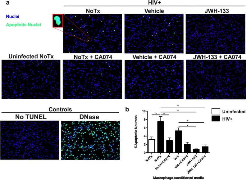 JWH-133 decreases HIV/MDM-induced neuronal apoptosis and CATB neurotoxic potential. Uninfected and HIV-infected MDM were untreated or treated with vehicle and JWH-133 (0.5 µM) for 12dpi. On day 13pi, MCM from donors that had increased CATB secretion after HIV-1 infection compared to the uninfected control were used to determine the effect of JWH-133 treatment in HIV/MDM-induced neuronal apoptosis and CATB neurotoxic potential. (a) Representative immunofluorescence images of human neuroblastoma cells that were exposed to MCM in the presence or absence of the CATB inhibitor, CA074. Cyan fluorescence indicates TUNEL positive cells (apoptotic neurons), whereas nuclei stained with DAPI are shown in blue. DNase and No TUNEL were included as positive and negative controls, respectively. (b) Cyan and blue nuclei were counted in at least 3 random fields per condition and results are shown as %Apoptotic Neurons. This figure is representative of four different donors (n = 4). Graphs are presented using the mean and the ± standard error of the mean (SEM). *p < 0.05.
