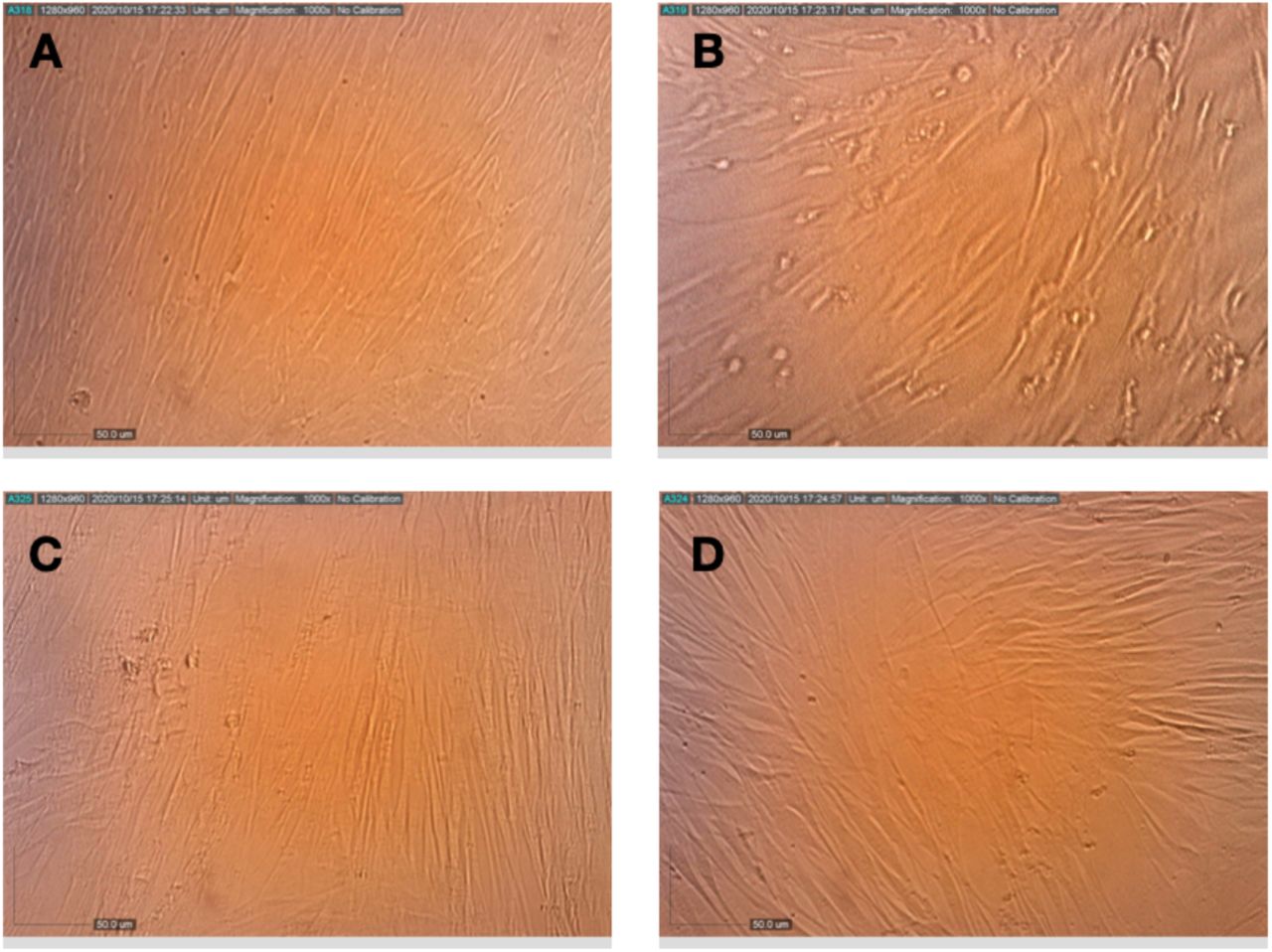 Effect of pretreatment of HCoV-229E with terpenes and CBD on its replication and cytopathic effect in MRC-5 cells. (A) Healthy MRC-5 cells, (B) MRC-5 cells at 72 h after infection with HCoV-229E that had been pretreated with assay medium, (C) MRC-5 cells at 72 h after infection with HCoV-229E that had been pretreated with terpenes and(D) MRC-5 cells at 72 h after infection with HCoV-229E that had been pretreated with terpenes and CBD.