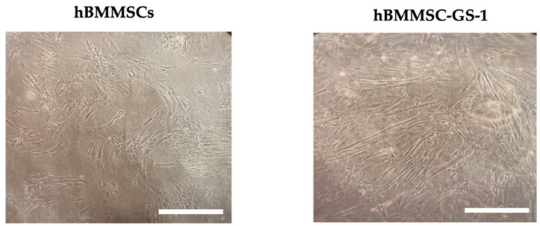 Representative observation of primary hBMMSCs derived from bioptic samples from GSD patient (B) and of primary hBMMSC line. Observation in phase contrast. Original magnification 10×. Scale bar: 200 μm.