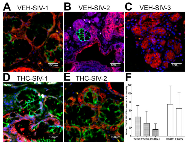 Chronic THC administration preserves TSC22D3 protein expression in the minor salivary glands (MiSGs) of chronically SIV-infected rhesus macaques. (A–E) Triple labels with TSC22D3 [48], cytokeratin (red) and Topro3 (blue) for nuclear staining. Note the significantly decreased TSC22D3 (A–C) staining in the minor salivary glands of the VEH/SIV rhesus macaques. In contrast, TSC22D3 (D,E) staining is intense in the MiSGs of the THC/SIV rhesus macaques. All panels are 40× magnification. Quantification of cells and regions of interest (ROI) labeled by TSC22D3 (F) was performed using Volocity 5.5 software after capturing images on a Leica confocal microscope. Several ROI were hand drawn on the MiSG regions in the images from three VEH/SIV and two THC/SIV rhesus macaques. The mean fluorescent intensity measurements for each animal are represented as mean ± standard deviation.