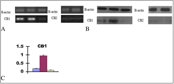 The expressions of CB1 and CB2 in HepG2 liver cells. A. The mRNA expression of CB1 and CB2 in HepG2 liver cells. B. The protein expression of CB1 and CB2 in HepG2 liver cells. C. The CB1 protein expression fold change in HepG2 cell, HepG2 fatty cell and rimonabant/HepG2-fatty cell was 0.28 ± 0.02,0.95 ± 0.04,0.12 ± 0.01 compare to B-actin as control, respectively (p < 0.05). HepG2; HepG2-fatty; Rimonabant/ HepG2-fatty. HepG2; HepG2-fatty. HepG2; HepG2-fatty; Rimonabant/HepG2-fatty.