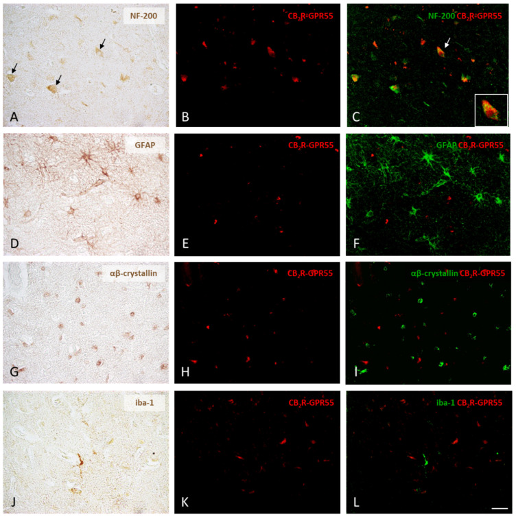 Expression of CB2R-GPR55 heteromers in neurons, oligodendrocytes, astrocytes, and microglia in the prefrontal cortex of the control subjects. Following the chromogenic immunohistochemical detection of the four different types of cells, those positive for NF-200, GFAP, αβ-crystallin, and iba-1 (A,D,G,J), CB2R-GPR55 heteromers were identified as red dots in cells with DAPI-stained nuclei using the PLA method (B,E,H,K). Digital overlays of PLA images (red fluorescent signal) and DAB immunolabeling images (the DAB signal converted into a green fluorescent signal) clearly showed that only neurons express CB2R-GPR55 receptor complexes (arrows), whereas oligodendrocytes, astrocytes, and microglia completely lack them (C,F,I,L). 40×. Detail: 100×. Scale bar 50 µm.