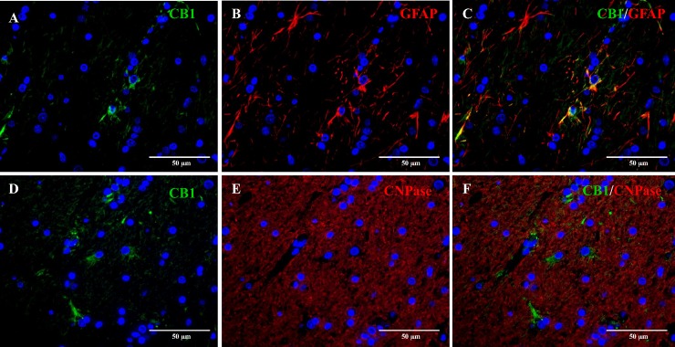 Double immunofluorescence staining of the cerebral white matter of a six-month-old Beagle dog.Double immunofluorescence staining of CB1 (green, A) with GFAP (red, B) reveals co-localization in about 20% astrocytes (C). CNPase expression (red, E) and CB1 (green, D) do not co-localize, suggesting a lack of expression of CB1 receptors by mature oligodendrocytes (F). Nuclear staining (blue) with bisbenzimide.