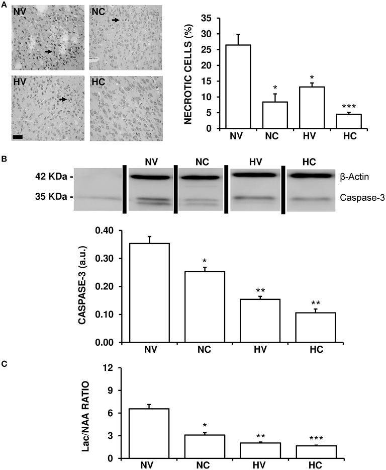 Effect of the treatments on the characteristics of brain lesion. (A) Representative light microphotographs of Nissl-stained brain sections, obtained from 1- to 2-day-old piglets after hypoxic-ischemic insult, treated with normothermia or hypothermia and administered with either vehicle or cannabidiol. The number of pyknotic cells was significantly higher in the NV group (arrows), while it was lower in the hypothermia and cannabidiol-treated groups. Original magnification x200, white bar: 100 μm. (B) Top: A representative image of immunoblotting using an anti-Caspase-3 antibody, carried out on the samples from 1- to 2-day-old piglets after hypoxic-ischemic insult, treated with normothermia, or hypothermia and administered with either vehicle or cannabidiol. Bottom: Densitometric analysis of relative caspase-3 contents. β-actin was used to normalize for differences in protein loading between lanes of the blot. (C) Changes in Lac/NAA ratio obtained by H+-MRS analysis of brain samples from 1- to 2-day-old piglets after hypoxic-ischemic insult, treated with normothermia or hypothermia and administered with either vehicle or cannabidiol. Lac: lactate; NAA: N-acetylaspartate. In all figures, bars represent mean ± SEM of 6–10 experiments. (a.u.) arbitrary units. (*) P < 0.05 vs. NV group by Kruskall-Wallis one-factorial analysis of variance; (**) P < 0.05 vs. both normothermic groups (NV and NC) by Kruskall-Wallis one-factorial analysis of variance; (***) P < 0.05 vs. all groups by Kruskall-Wallis one-factorial analysis of variance.