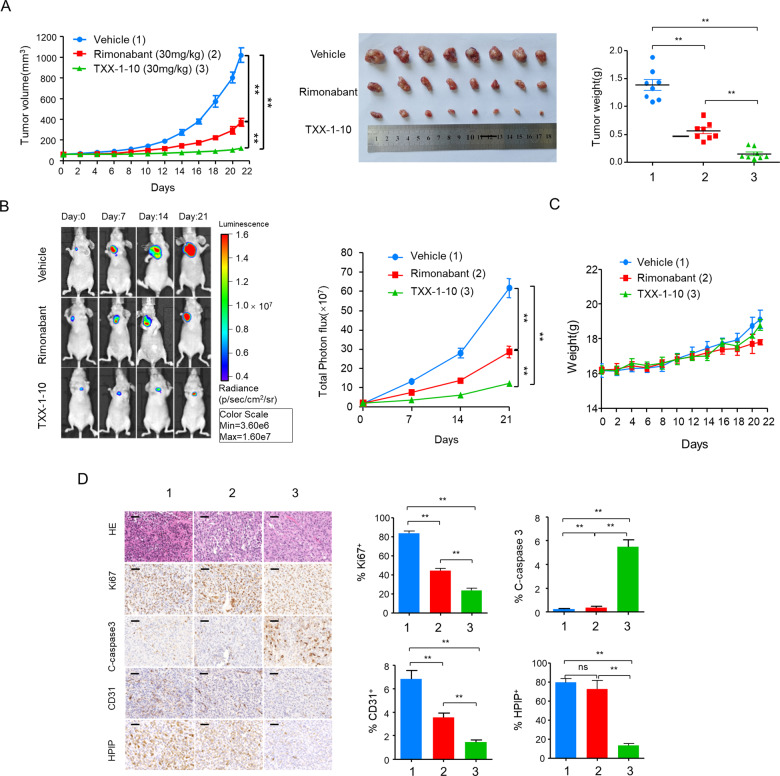 TXX-1-10 represses breast tumor growth in vivo.A Bioluminescent MDA-MB-231 cells were subcutaneous transplanted into BALB/c mice. Mice were treated with vehicle control, rimonabant (30 mg/kg) or TXX-1-10 (30 mg/kg) 5 days after xenograft as indicated and tumor size was monitored every other day. Photograph of tumors and tumor weight of animals administrated with TXX-1-10, rimonabant or vehicle control are shown (n = 8 per group). B Representative bioluminescent images of animals were taken at the day 0, 7th-, 14th-, and 21st-day postbioluminescent MDA-MB-231 xenografts (left panel). Quantification of tumor cells in mice body was performed with bioluminescence analysis (right panel) (n = 8 per group). C Body weight of BALB/c mice treated with vehicle control, rimonabant (30 mg/kg) or TXX-1-10 (30 mg/kg) as indicated are shown (n = 8 per group). D Representative images of H&E, Ki67, cleaved-caspase 3, HPIP, and CD31 immunohistochemical (IHC) staining in harvested tumors from each group are shown (left panel). Histograms show the quantification of Ki67+, cleaved-caspase 3+ cells, CD31+ cells, and HPIP + cells (right panel). Scale bar: 50 μm. Data shown are mean ± SD of triplicate measurements that have been repeated three times with similar results. p values were determined by two-tailed Student’s t test (*p < 0.05, **p < 0.01). Statistical significance was assessed by two-tailed Student’s t test. (ns not significant; *p < 0.05, **p < 0.01). **p < 0.01 on the final day A, B.