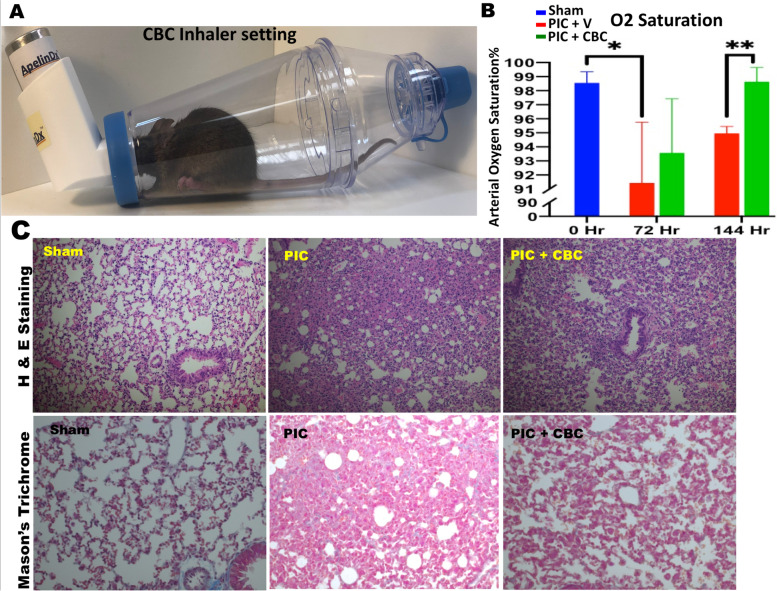 Inhalant cannabichromene (CBC) improved pulmonary function. A Treating mouse model of acute respiratory distress syndrome (ARDS) with inhalant CBC, specifically designed cone-shaped spout of the inhaling device (ApelinDxtm) connected to spacer completely sealed for a soft, comfortable, and insuring delivery of inhalant CBC to the mice. B Blood oxygen saturation was increased by ~8% towards a normal level (Blue bar) in mice treated with Poly (I:C) (PIC) followed by the treatment of inhalant CBC (PIC + CBC) (Green bar) compared to the untreated group (PIC) (Red bar) (**p<0.05, bars show means +/− standard deviation, SD). C Histological analysis, hematoxylin and eosin (H&E upper panels), and Masson’s trichrome (MT lower panels) demonstrated that Poly (I:C) caused the destruction of morphology and architecture of lung in mice with ARDS compared to the normal control group (sham). Inhalant CBC was able to improve the lung structure towards a normal status (PIC + CBC)