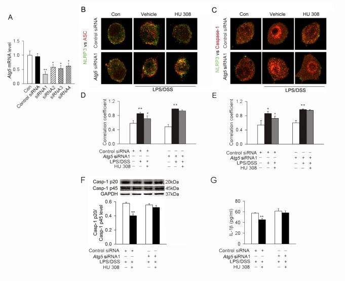 Autophagy mediates the inhibitory effect of CB2R on NLRP3 inflammasome initiation and activation stimulated with LPS/DSS in vitro.(A) The quantitative expression of mRNA in RAW264.7 cells after transfection with control siRNA or Atg5 siRNAs. n = 6 per group. *P<0.05 vs. the control siRNA, **P<0.01 vs. the control siRNA. (B and C) After transfection with control siRNA or Atg5 siRNA, RAW264.7 cells were primed with LPS (10 ng/ml) for 1 h, and then were stimulated with 3% DSS in the presence or absence of HU 308 (10 μM) for 24 h. Cells were fixed and colocalization of NLRP3 with ASC and NLRP3 with Casp-1 were observed using a confocal laser scanning microscope. Representative images of the colocalization of NLRP3 (green) with ASC or Casp-1 (red). (D and E) Quantitative analysis showing the fold change in Pearson coefficient correlation (PCC) for the colocalization of NLRP3 with ASC and NLRP3 with Casp-1. Atg5 siRNA attenuated the inhibitory effect of HU 308 the colocalization of NLRP3 with ASC and NLRP3 with Casp-1. n = 6 per group. *P<0.05 vs. control, **P<0.01 vs. control, #P<0.05 vs. LPS/DSS. (F and G) After transfection with control siRNA or Atg5 siRNA, RAW246.7 cells were primed with LPS (10 ng/ml) for 1 h, and then were stimulated with 3% DSS in the presence or absence of HU 308 (10 μM) for 24 h. Western blot was conducted to test Casp-1 p20 in supernatants and Casp-1 p45 and GAPDH in lysates, and the expression of Casp-1 p20/Casp-1 p45 ratio was analyzed. IL-1β secretion in the supernatant was tested by ELISA. HU 308 decreased the level of Casp-1 p20/Casp-1 p45 ratio and IL-1β secretion. Atg5 siRNA attenuated the inhibitory effect of HU 308 on Casp-1 p20/Casp-1 p45 ratio and IL-1β secretion. n = 8 per group. **P<0.01 vs. LPS/DSS.
