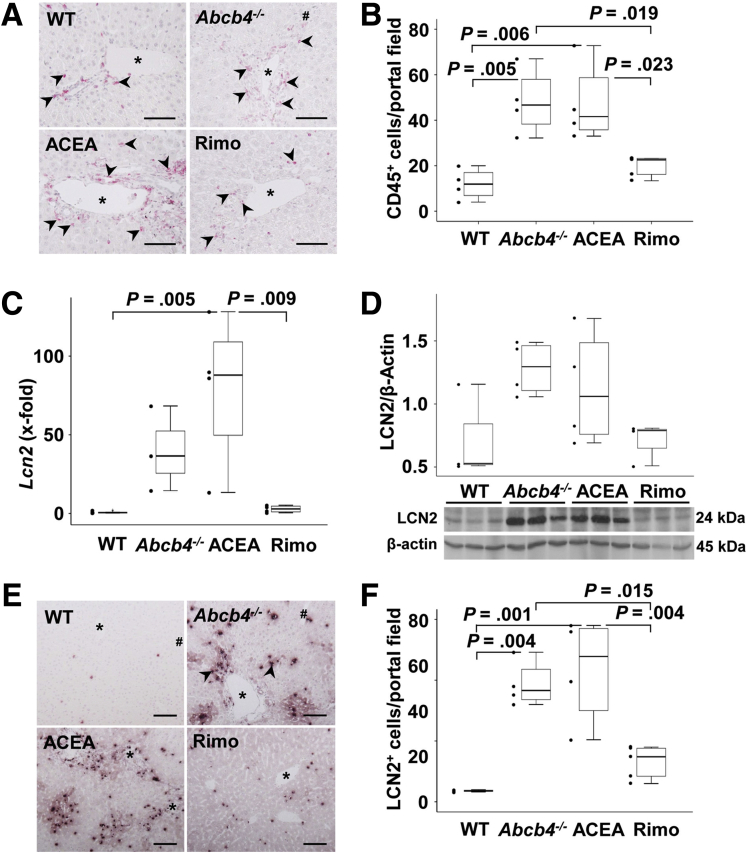 Rimonabant reduced hepatic inflammation in Abcb4-/-mice. (A and B) Immunostaining of CD45 and counting of positive cells per portal field indicated enhanced numbers of CD45+ cells (arrowheads) infiltrated in the portal tracts of Abcb4-/- and ACEA-treated mice, while treatment with rimonabant reduced the numbers of these cells. Original magnification: 200×. n = 4–5 mice per group. CD45+ cells in at least 5 randomly chosen portal tracts were counted. (C) Hepatic mRNA of Lcn2 was enhanced in ACEA-treated mice and normalized to WT control levels by rimonabant treatment. (D) Western blot analysis suggested comparable protein regulation of LCN2 protein as observed on mRNA level (C). Nevertheless, densitometric and statistical analysis did not show significant differences between the groups. These are representative immunoblotting data of 2 independent experiments. (E and F) Immunohistochemistry showed enhanced numbers of LCN2-positive cells in Abcb4-/- mice and reduced hepatic infiltration of LCN2-positive cells (arrowheads) in rimonabant-treated mice. Original magnification: 100×. (B–D and F) One-way analysis of variance and post hoc Bonferroni tests were used for statistical analysis. n = 3–5 mice per group. One of 3 independent experiments of mRNA analyses is shown. Scale bars: 100 μm. ∗Portal vein. Rimo, rimonabant.