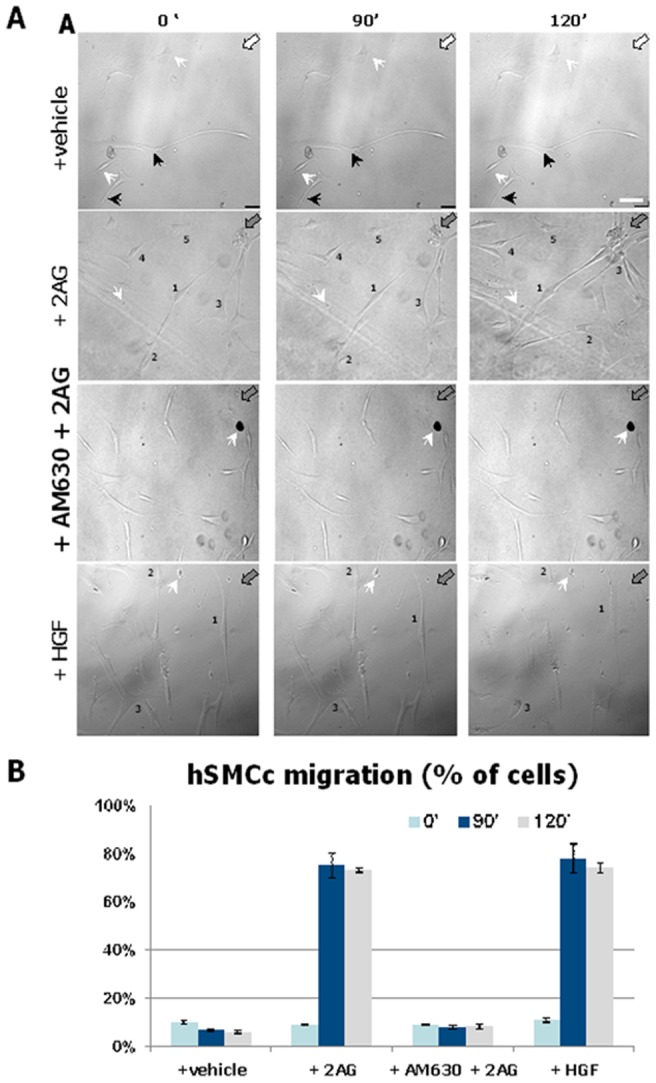 2-AG is Chemoattractant for hMSCs through CB2 receptor.(A) Image-based detection of 2-AG chemoattractive effect on cultured hMSCs. Representative morphological data of hMSCs time-lapse migration recorded at starting point (0 min), 90 min and 120 min from the 2-AG (filled gray arrows) or vehicle (white arrows) exposure. The cells were maintained in the relative medium or pretreated with the CB2 antagonist AM630 (lower panel) 15 min before the exposure to 2-AG during the chemotaxic assay. The arrowheads indicate static reference points in the cell port chamber; the black arrows point to soma or cellular processes without noticeable movements. The numbers indicate the hMSCs or their processes affected by 2-AG chemoattractive movements. Scale bar = 30 microns. A source of HGF has been used as positive control. (B) Quantative data of percentage of hMSCs effected by chemotaxic movements. n = 300 cells per each treatment. *** P<0.0001 of hMSCs migration toward 2-AG at 90 min and 120 min versus hMSCs migration at each different treatment and time course.