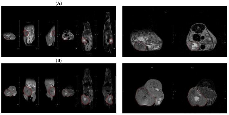 Tumor tissue segmentation and VOI definition at baseline (A) and after treatment (B). VOI definition of the tumor at the baseline imaging staging (day 8) in T1; red highlight (transversal, craniocaudal and anteroposterior aspects); and T2; red highlight (transversal, craniocaudal and anteroposterior aspects). VOI definition of the tumor at the end of the experiment (day 26) in T1; red highlight (transversal, craniocaudal and anteroposterior aspects); and T2; red highlight (transversal, craniocaudal and anteroposterior aspects).