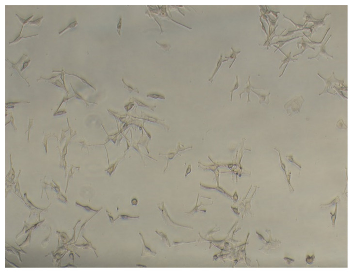 Normal human epidermal melanocytes (NHEMs) during cultivation.