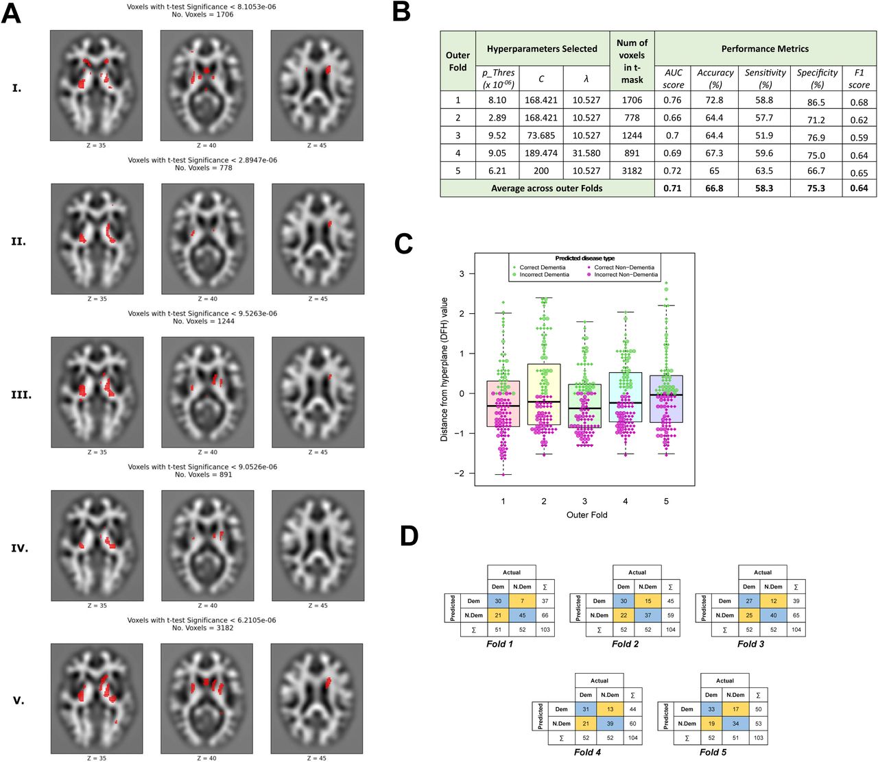(A) Significant Voxels Overlaid on COLIN Brain Scan for (I) Fold 1, (II) Fold 2, (III) Fold 3, (IV) Fold 4 and (V) Fold 5. The COLIN Brain Scan was pre-processed by segmenting into grey matter and smoothed using scalar momentum. The three scans in each row display different axial slices, inferior to superior across from left to right. (B) Overall summary of performance metrics; (C) Distribution of DTH value for prediction outcomes and (D) Confusion matrices across 5-fold nested cross-validation