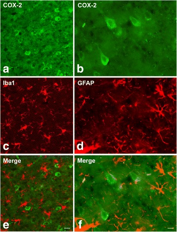 Double immunofluorescence for cyclooxygenase-2 (COX-2) (a, b, e, f) and either Iba1 (c, e) or glial fibrillary acidic protein (GFAP) (d, f) in the frontal cortex of BCCAO/R rats. Scale bars E = A, C: 25 μm; F = B, D: 10 μm