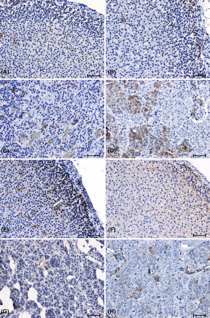 Immunohistochemical reaction determing CB2 receptor in adrenal glands of normotensive (A–D) and hypertensive (E–H) rats. Adrenal cortex and medulla of WKY rat (A, C), sham‐operated rat (B, D); Adrenal cortex and medulla of SHR rat (E, G); 2K1C rat (F, H). Scale bar = 50 μm.