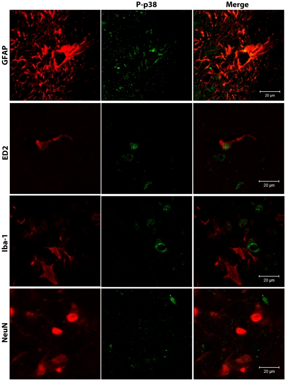 Phospho-p38 is expressed in astrocytes and perivascular microglia.Confocal analysis was used to determine phospho-p38 (P-p38) cellular localization in the superficial laminae of the ipsilateral L5 dorsal horn in AM281 + AM630-treated rats on day 15 after paw incision. Representative images are shown. Phospho-p38 appears in green. GFAP (marker for astrocytes), ED2/CD163 (ED2, marker for perivascular microglia), Iba-1 (marker for microglia) and NeuN (marker for neurons) appear in red. The color of ED2/CD163, Iba-1 and NeuN staining was digitally changed from green to red, and phospho-p38 from red to green for consistency in presenting the data and in order to allow a better visualization of the co-localization of these markers. The colors of the GFAP/phospho-p38 co-stain (top panel) were not altered.