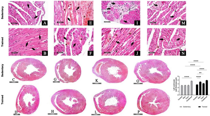 Examination of H&E-stained heart sections under light microscope of sedentary and trained rats showing degenerative changes (arrow) and focal hemorrhage (star). Left ventricular wall thickness. Stanozolol administration (E–H), cannabis administration (I–L), and both substances administration (M–P) presented focal subendocardial degeneration and necrotic cardiomyocytes with nuclear pyknosis (arrow), moderate increased intermuscular spaces with congested vasculatures (star), and increased fibroblastic activity that were more prominent in the combined group. Left ventricular wall thickness data were obtained using Full HD microscopic imaging system (Leica Microsystems GmbH, Germany) operated by Leica Application software for tissue sections analysis and representative samples were selected for imaging. Data in graph are presented as mean ± SEM and tested for significance at p < 0.05 using two-way ANOVA followed by Tukey's multicomparison test (n = 6)