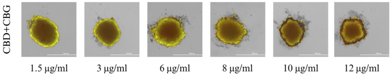 Spheroid culture after 48 h of incubation with a combination of CBD+CBG. Abbreviations: CBD—cannabidiol; CBG—cannabigerol. The scale bar is 1000 µm.