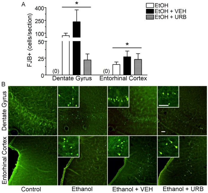 Fatty acid amide hydrolase inhibition by URB597 failed to attenuated binge ethanol induced neurodegeneration of cortico-limbic circuitry. Rats received ethanol or control diet according to a modified Majchrowicz binge model and were co-administered nothing (n = 5 for control diet, n = 10 for ethanol diet), vehicle (n = 5 for control diet, n = 6 for ethanol diet) or URB597 (0.3 mg/kg, n = 5 for control diet, n = 10 for ethanol diet) every 12 h starting after the third dose of ethanol or control diet. Following binge ethanol treatment, neurotoxicity was assessed in the ventral dentate gyrus of the hippocampus and in the entorhinal cortex by FluoroJade B (FJB) staining. (A) Quantification of FJB+ neurons in the dentate gyrus and entorhinal cortex. No FJB+ cells were observed in controls as indicated by (0). URB597 failed to significantly attenuate neurotoxicity in either brain region of interest. (B) Representative images of FJB+ staining. Note the neuronal morphology of FJB+ cells. Scale bar = 50 µm. * p < 0.05 as compared to FJB+ cell counts in respective brain regions of control treated rats. Ethanol (EtOH); vehicle (VEH); URB597 (URB).