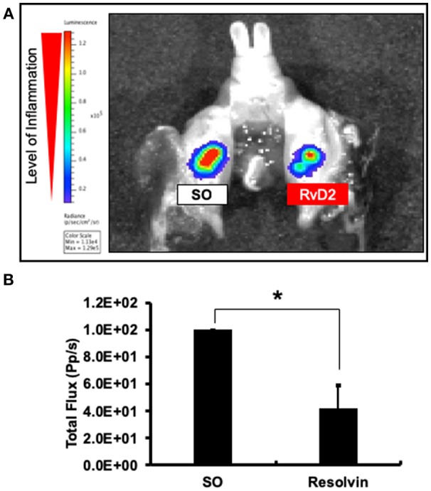 Molecular imaging analysis examining the effects of RvD2 on periapical inflammation. Images of the signal intensity of MPO activity around RvD2 treated and non-treated tooth are shown (A). Results of comparisons of the levels of signal intensity with respect to total flux are shown (B). Data represent the means of three independent rats (SO on left side and RvD2 on right side for each rat), with error bars indicating standard deviations. *P < 0.05 indicates significant differences compared to the control group, Mann–Whitney test.