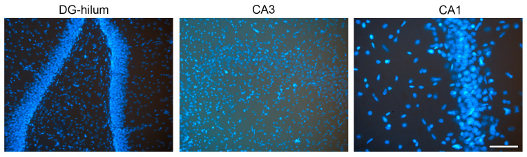 Examples of HF images obtained to analyze different areas and protein expression: DG-hilum, CA3, and CA1. Bar = 200 μm.