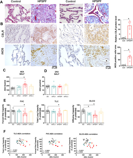 Histological and biochemical evidence from patients for pathologic involvement of endocannabinoid/CB1R and iNOS systems in HPSPF. Masson trichrome staining sections from HPSPF patients and controls without fibrotic lung disease (A). CB1R and iNOS immunohistochemistry from the same subjects (B). AEA (C) and 2‐AG (D) levels in BALF from normal volunteers (NV), HPS‐1 patients without fibrosis, patients with HPSPF and HPS‐3 patients. Pulmonary function tests (PFTs) in the same groups (E). Abbreviations: DLCO, diffusion capacity; FVC, forced vital capacity; TLC, total lung capacity. Correlation between PFTs and AEA in BALF in NV, HPS‐1, and HPSPF (F). NV: empty black symbol, HPS1: blue symbol, HPSPF: red filled symbol, HPS3: empty yellow symbol. Correlation was calculated by using Pearson correlation coefficients. Data represent mean ± SEM from five subjects for histology in each group, and 16 NV, 6 HPS‐1, 10 HPSPF, and 3 HPS‐3 subjects for BALF and PFTs. Data were analyzed by t‐test for comparison of histological scoring and by one‐way ANOVA followed by Dunnett's multiple comparisons test for endocannabinoids and PFT. * (p < 0.05) indicates significant difference from the NV group