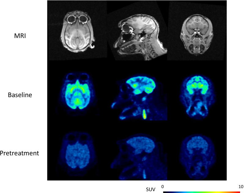 Representative MRI and PET summation images (0–63 min) of [11C]PF-06809247 at baseline and following pretreatment with a selective MAGL inhibitor (NHP4; 0.42 mg/kg)