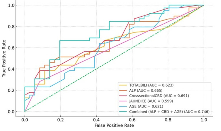 ROC Curves for individual predictors and combined modelROC curves showing the diagnostic performance of individual predictors—total bilirubin (AUC = 0.623), ALP (AUC = 0.665), CBD diameter on cross-sectional imaging (AUC = 0.691), clinical jaundice (AUC = 0.599), and age (AUC = 0.621)—and the combined model (ALP + CBD diameter + age; AUC = 0.746); the diagonal dashed line represents no discrimination (AUC = 0.50). ROC curves evaluate diagnostic accuracy; higher AUC values indicate better discrimination, with the combined model outperforming individual predictors.ALP: alkaline phosphatase; TOTALBILI: total bilirubin; CBD: common bile duct; AUC: area under the curve; ROC: receiver operating characteristic