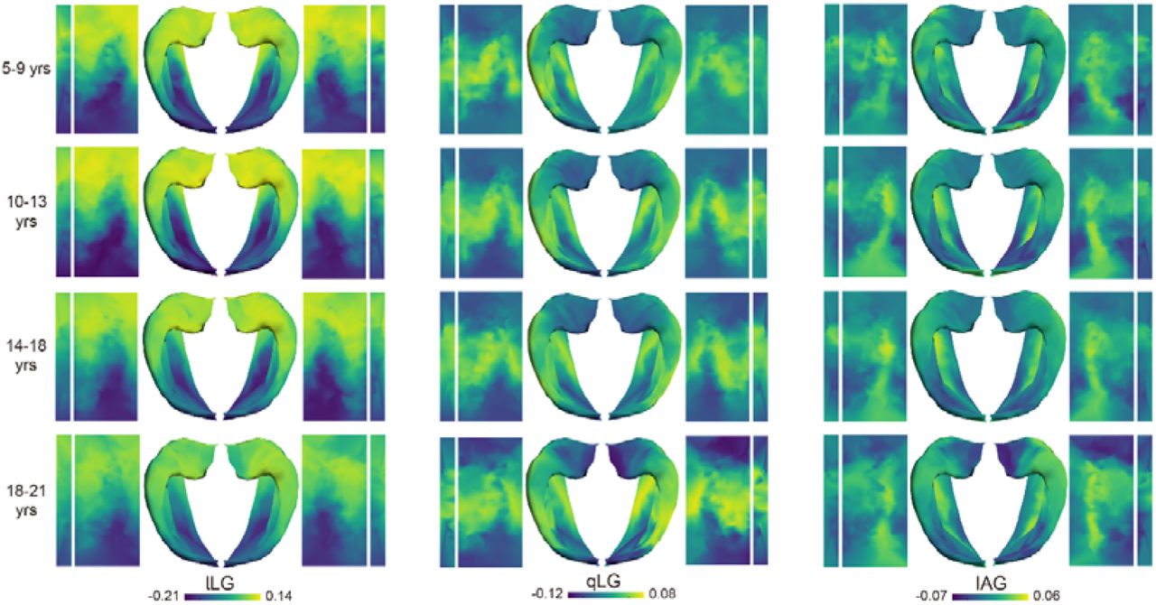 Topographic pattern of the first three gradients presented within four age-specific groups (5-9, 10-13, 14-17, and 18-21 years).
