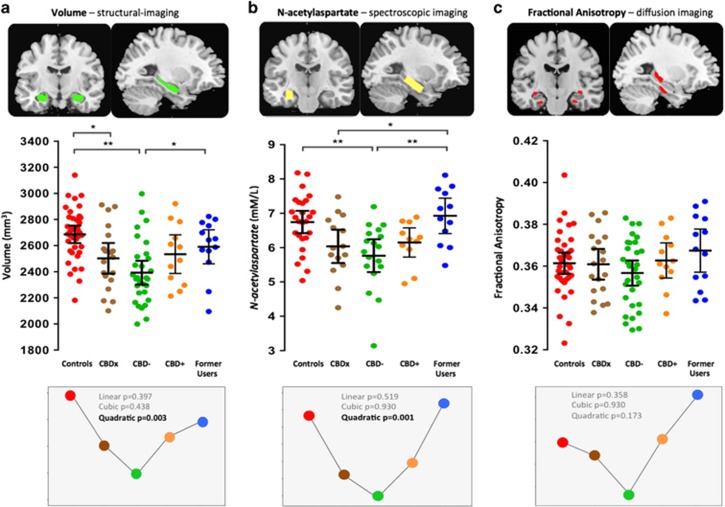 Scatter plots illustrate hippocampal: (a) volume; (b) N-acetylaspartate; and (c) fractional anisotropy levels in long-term cannabis users and non-using controls. Controls (n=37) are shown in red. Long-term cannabis users (n=74) comprise three groups: CBDx, those with unknown exposure to CBD (n=19, in brown); CBD−, those known to be exposed to THC but not to CBD (n=30, in green); and CBD+, those exposed to both THC and CBD (n=12, in orange). Former Users, former long-term cannabis users, abstinent for a mean 29 months (n=13, in blue). Horizontal lines represent group means and horizontal bars are the 95% confidence interval. *P<0.05; **P<0.005. Lower panels illustrate the curve-fitting and polynomial contrasts that were applied to the data across the five groups to model our investigational aims.