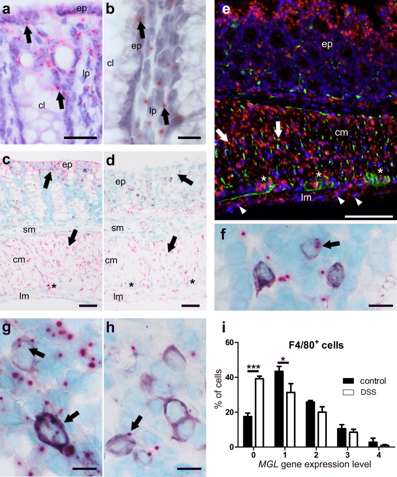 ISH staining of MGL mRNA in colon of healthy (a–c, e–g) and DSS-treated mice (d, h). MGL mRNA (FastRed) is seen in cells of the epithelium (ep) and the lamina propria (lp) (a, b), myenteric ganglia (casterisk), and in the circular (cm) and longitudinal (lm) muscle layer (c) of healthy colonic mucosa. In contrast, MGL gene expression drops throughout the whole colon after DSS treatment, particularly in the epithelium (ep) and the circular muscle layer (cm) (d, arrows). c and d Taken from ISH/IHC double staining of MGL mRNA (FastRed) and CD3 protein (purple, VIP). Immunofluorescence shows that MGL mRNA (red, FastRed) is abundantly stained in the circular (cm) as well as the longitudinal (lm; arrowheads) muscle layer (e). Co-localization of MGL mRNA with synaptophysin (green, Alexa 488) is rather low (yellow dots; arrows; e). There is only little MGL gene expression (pink, FastRed) in CD3+ cells (purple, VIP) (f). Gene expression of MGL in F4/80+ cells (purple, VIP) is decreased after DSS treatment (h) as compared to healthy animals (g). Quantification of MGL mRNA in F4/80+ cells in healthy versus diseased animals is shown in i; note the increased cell number in expression level 0 (no expression) and reduced number of cells in expression level 1. Calibration bar in a 20 µm; calibration bars in b, f, g, h 10 µm; calibration bars in c, d 50 µm; calibration bar in e 100 µm; cm circular muscle layer, ep epithelium, lp lamina propria, lm longitudinal muscle layer, cl crypt lumen, sm submucosa; *, myenteric ganglia. Arrows point at representative cells expressing MGL mRNA