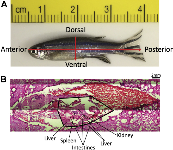 Zebrafish orientation. A: All fish shown in IR-MALDESI-MSI images are presented in anterior to posterior and dorsal to ventral orientation. B: Representative histology image of a VDD fish with the visceral cavity (liver, intestines, spleen, and kidney) labeled.