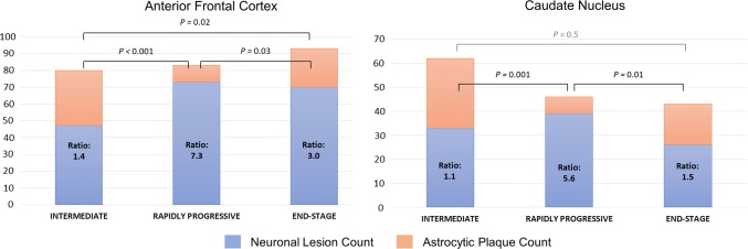Neuronal-To-Astrocytic Plaque Ratios of the Intermediate (Int-CBD), Rapidly Progressive (RP-CBD) and End-Stage (ES-CBD) Groups of the Anterior Frontal Cortex and Caudate Nucleus. The ratios for both regions in the RP-CBD group were significantly greater than the Int-CBD and ES-CBD groups, indicating proportionally higher number of neuronal lesions (neurofibrillary tangles and pretangles) than astrocytic plaques in RP-CBD cases