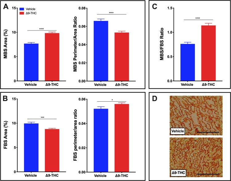 Exposure to 3 mg/kg Δ9-THC during gestation leads to increased maternal blood space to fetal blood space ratio in the labyrinth zone at E19.5 compared to vehicle treatment. (A) Percentage of maternal blood area and maternal blood space perimeter/area ratio in labyrinth zone. (B) Percentage of fetal blood area and fetal blood space perimeter/area ratio in labyrinth zone. (C) Maternal blood space to fetal blood space ratio in labyrinth zone. (D) Representative images of fetal blood spaces identified by Iso-Lectin B4 staining. 6-images/placenta were taken at 40×. Graphs present mean ± SEM. Significance; Student’s t-test (*P < 0.05, **P < 0.01, ***P < 0.001 ****P < 0.0001). Scale bar = 100 uM.