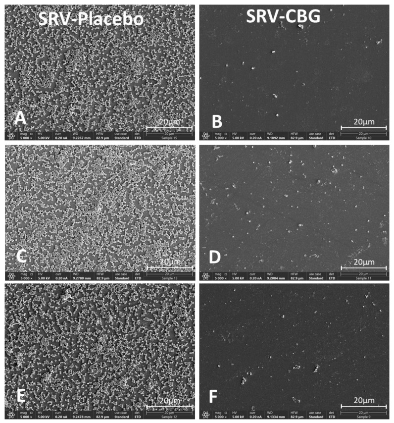 HR-SEM images of biofilms formed on the plastic well 24 h after the fifth exposure of SRV-placebo (A,C,E) or SRV-CBG-coated (B,D,F) meshes to S. aureus. A ×5000 magnification is shown. Images from three different samples of each group are shown.