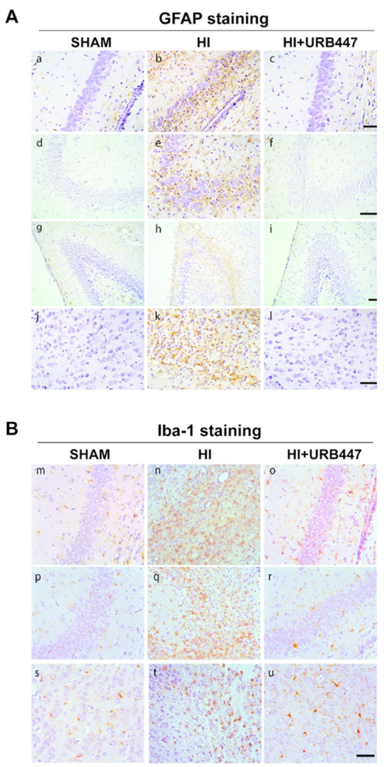 Modulation of glial fibrillary acidic protein (GFAP) and ionized calcium binding adaptor molecule-1 (Iba-1) staining by neonatal hypoxia-ischemia (HI) and treatment with URB447. (A) Representative light microphotographs illustrating GFAP immunostaining in brain sections from CA1 (a–c) and CA2/CA3 (d–f) hippocampal regions, dentate gyrus (g–i) and cortex (j–l). Samples were obtained from 14-day-old rats subjected to sham operation (SHAM; a, d, g, j) or to HI on P7 and treated with either vehicle (HI; b, e, h, k) or URB447 (HI+URB447; c, f, i, l). (B) Representative light microphotographs illustrating Iba-1 immunostaining in brain sections from CA1 (m–o) and CA2/CA3 (p–r) hippocampal regions and cortex (s–u). Samples were obtained from 14-day-old rats subjected to sham operation (SHAM; m, n, o) or to HI on P7 and treated with either vehicle (HI; n, q, t) or URB447 (HI+URB447; o, r, u). Bars, 100 μm.