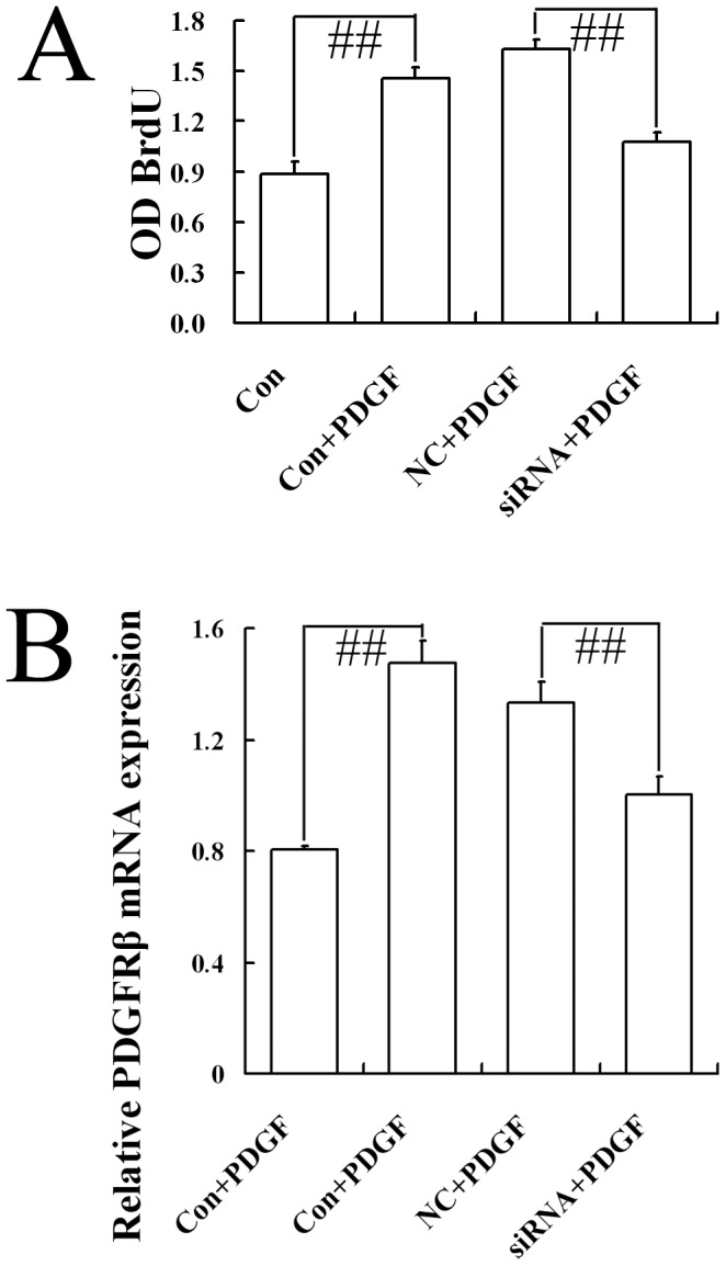 Effect of CB1-RNAi-LV on the proliferation of primary hepatic stellate cells.(A) The statistical results of the optical density (OD) value of BrdU incorporative cells in HSCs (named Con), HSCs with PDGF (named Con+PDGF), HSCs with NC-LV and PDGF (named NC+PDGF), HSCs with CB1-RNAi-LV and PDGF (named siRNA+PDGF) by ELISA method. “# #” p<0.01. Results showed that the proliferation of HSCs stimulated by PDGF-BB elevated significantly than HSCs alone. NC-LV transfection did not affect the proliferation of HSCs stimulated by PDGF-BB. Furthermore, the proliferation of HSCs stimulated with PDGF-BB and transfected with CB1-RNAi-LV decreased markedly than that of HSCs stimulated with PDGF-BB and transfected with NC-LV. (B) The statistical results of PDGFR-β mRNA expression in HSCs (named Con), HSCs with PDGF (named Con+PDGF), HSCs with NC-LV and PDGF (named NC+PDGF), HSCs with CB1-RNAi-LV and PDGF (named siRNA+PDGF) by RT-PCR analysis. Relative expression levels of mRNA were normalized against those of GAPDH mRNA. “# #” p<0.01. Results showed that PDGFR-β mRNA expression increased markedly by PDGF-BB pretreatment or by PDGF-BB pretreatment plus NC-LV transfection, while PDGFR-β mRNA expression in HSCs pretreated with PDGF-BB and transfected with CB1-RNAi-LV decreased markedly than that in HSCs pretreated with PDGF-BB and transfected with NC-LV.