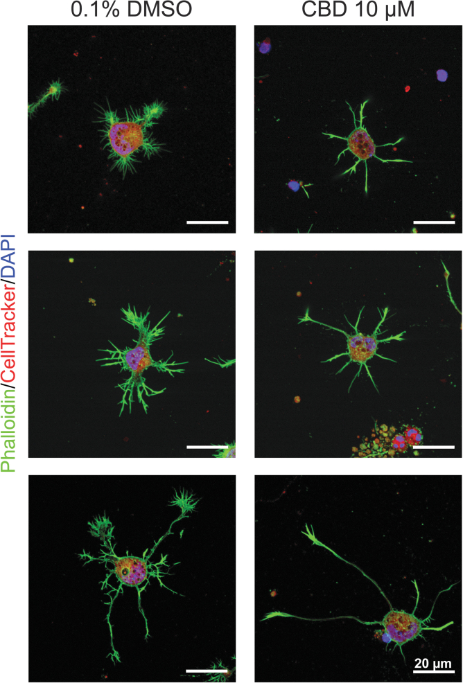 Effects of CBD on cell adhesion and morphology. Representative CLSM images of primary hippocampal neurons in CBD (10 μM) or 0.1% DMSO, after staining F-actin (green), cytoplasm (red), and nuclei (blue). DMSO, dimethyl sulfoxide.