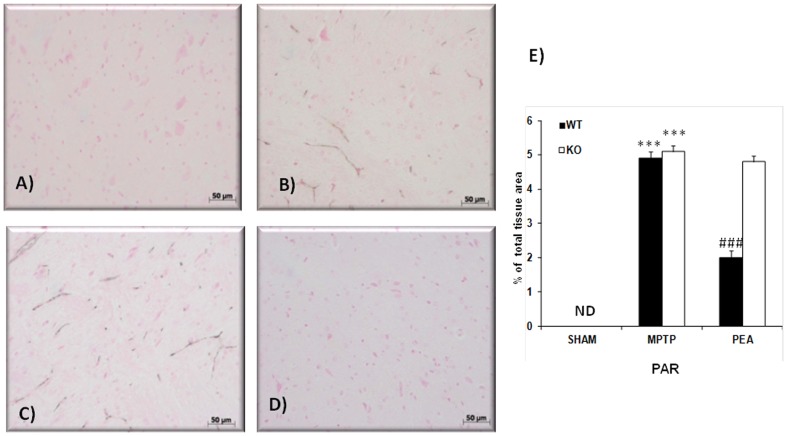 Effects of PEA on PARP activation.Brain sections were processed to determine the immunohistological staining for PAR, product of PARP activation. No positive staining for PAR observed in SN from PPARαKO sham-operated mice (A and E). A substantial PAR formation was found in inflammatory cells in SN from MPTP-injectd PPARαWWT and PPARαKO (B and C, respectively). PAR formation was significantly attenuated in PEA-treated MPTP PPARαWT mice (D and E). This figure is representative of at least 3 experiments performed on different experimental days.