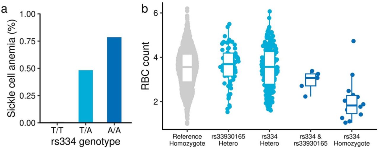 Penetrant association of rs334 for sickle cell anemiaa, The prevalence of Sickle cell anemia by rs334 genotypes. b, The RBC measurements in the MGB participants by combined genotype of rs33930165 and rs334. The box plot depicts the first and third quartiles, with the line inside the box indicating the median value. RBC, Red Blood Cell count.