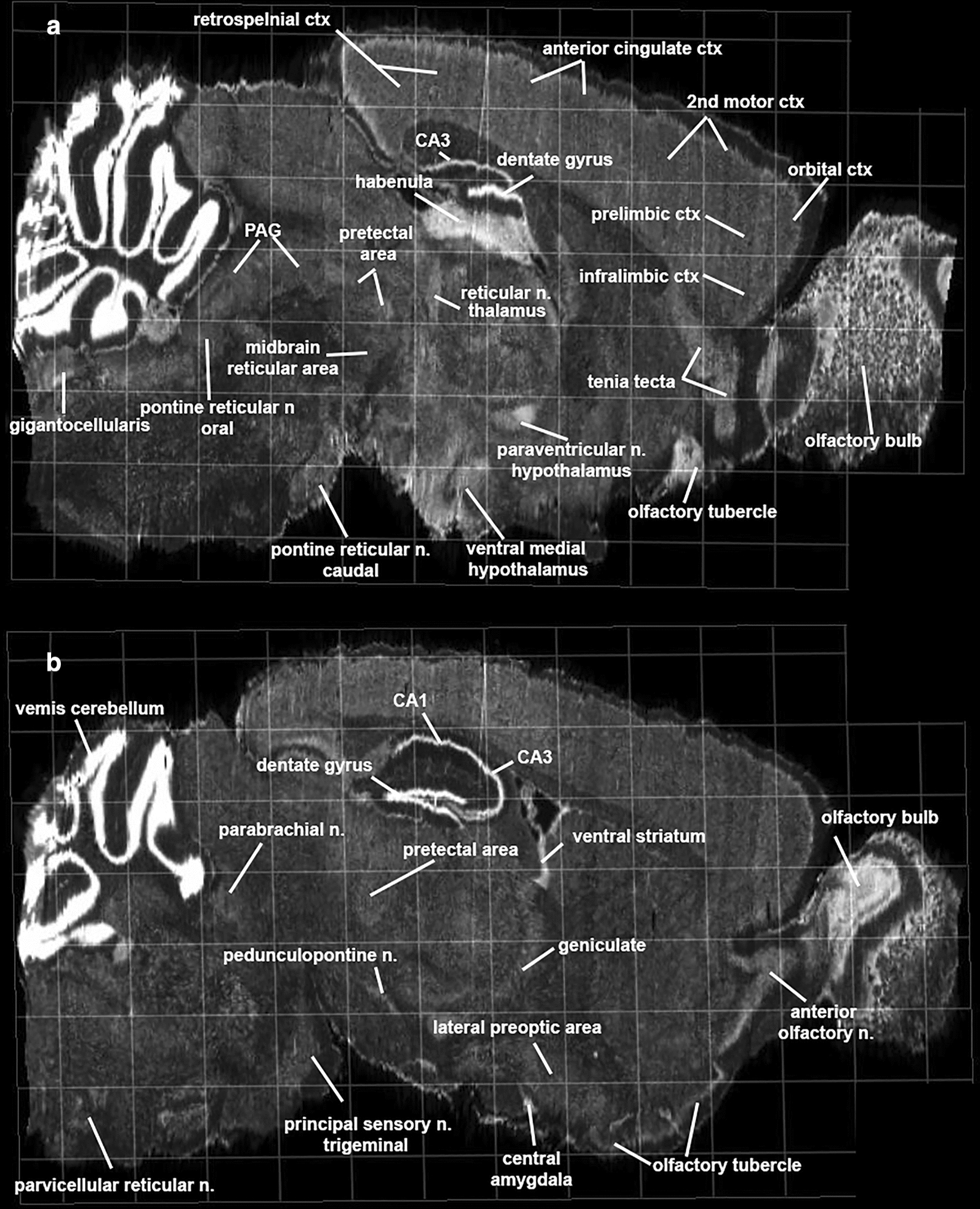 N-acyl-phosphatidylethanolamines -specific phospholipase D mRNA. Shown are autoradiograms of in situ hybridization of NAPD-PLD messenger RNA in mouse brain. The sagittal section A and B extend medial to lateral. Abbreviations PAG—periaqueductal gray. Image credit: Allen Institute